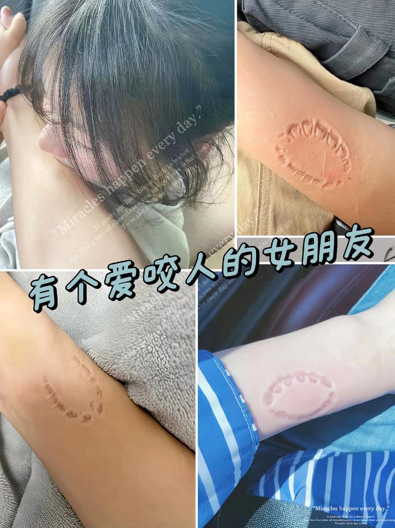 新澳2025正版免費資料和狗闯村民家咬伤女童与村里的狗咬人,应该找谁解决
